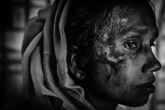 Rohingya